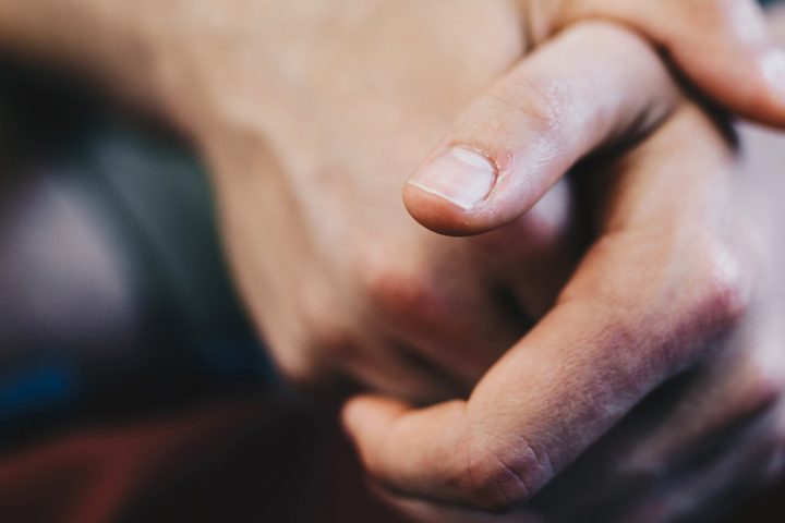 低温やけどしてしまったお肌のお手入れ方法